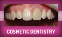 Cosmetic Dentistry