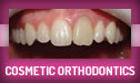 Cosmetic Orthodontics