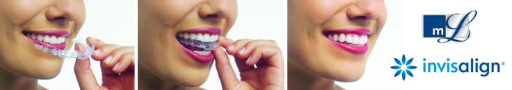 Ortodoncia Invisible Invisalign Rosario Ortodoncia